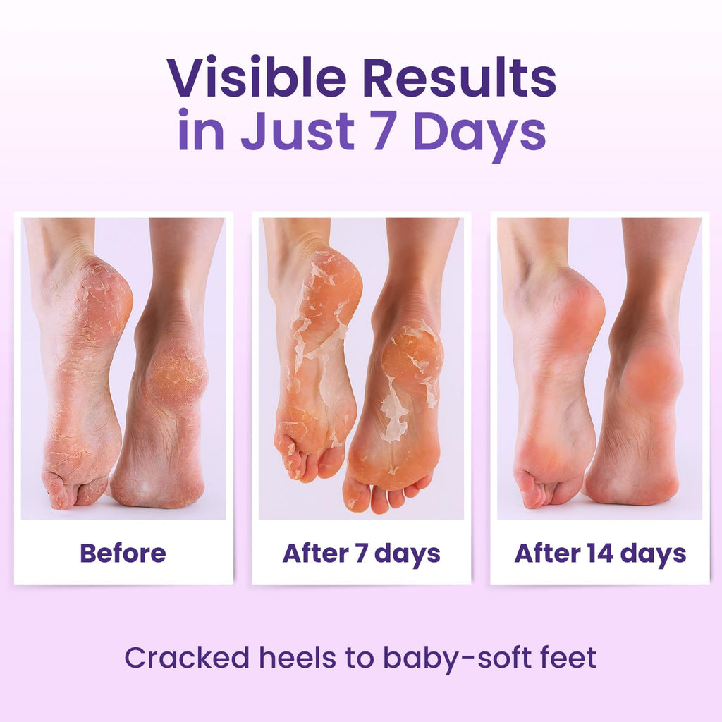 Bloomora callus remover foot mask six pairs bundle layout