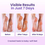 Bloomora callus remover foot mask six pairs bundle layout