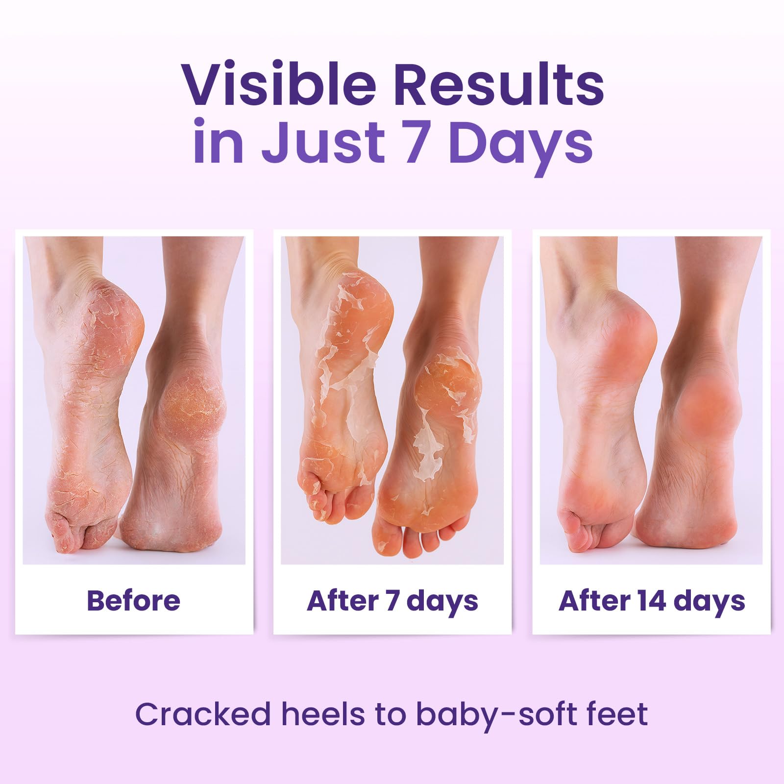 Salicylic and lactic acid foot peel mask application steps illustration