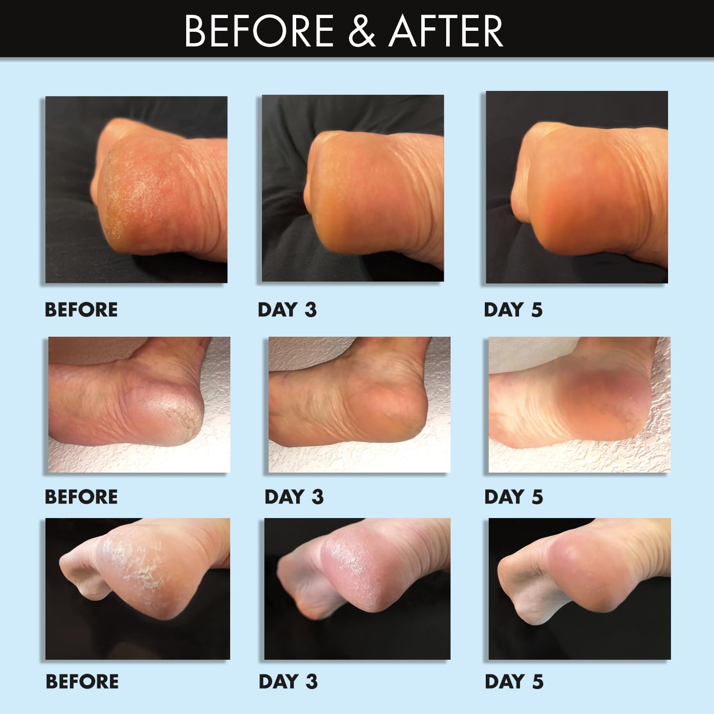 Whish exfoliating foot mask tube showing ingredients and 2.5 fluid ounce size.