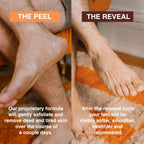 Kitchenzaa Feets foot mask sock booties laid out flat