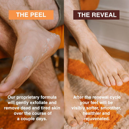 Comparison of dry cracked heels before and after using FEETS exfoliation mask.