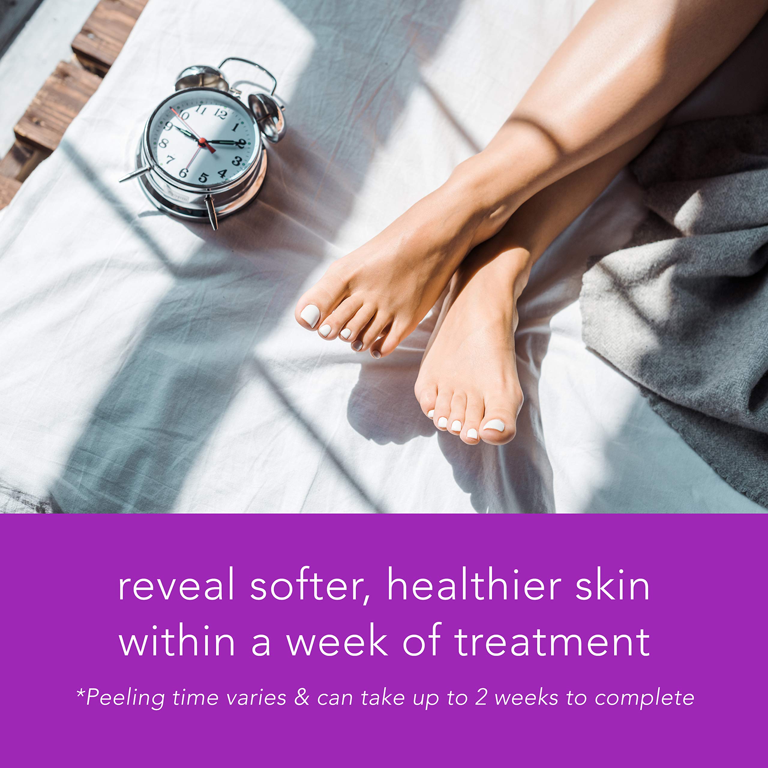 Step by step application of the Reboot ultra soft foot peel
