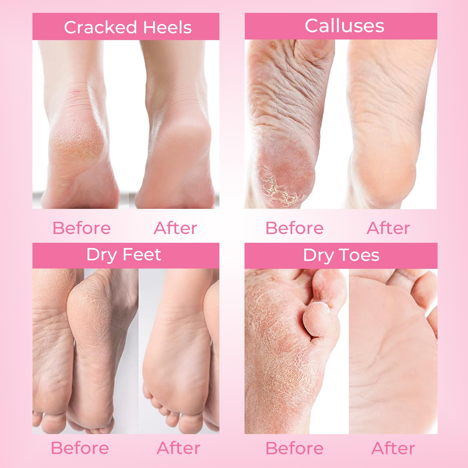 SAISZE exfoliating foot mask booties being secured at the ankle with tape