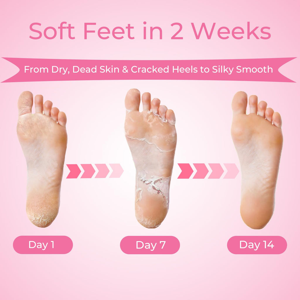 Saisze lavender scented foot peel sock booties laid flat