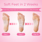 Saisze lavender scented foot peel sock booties laid flat