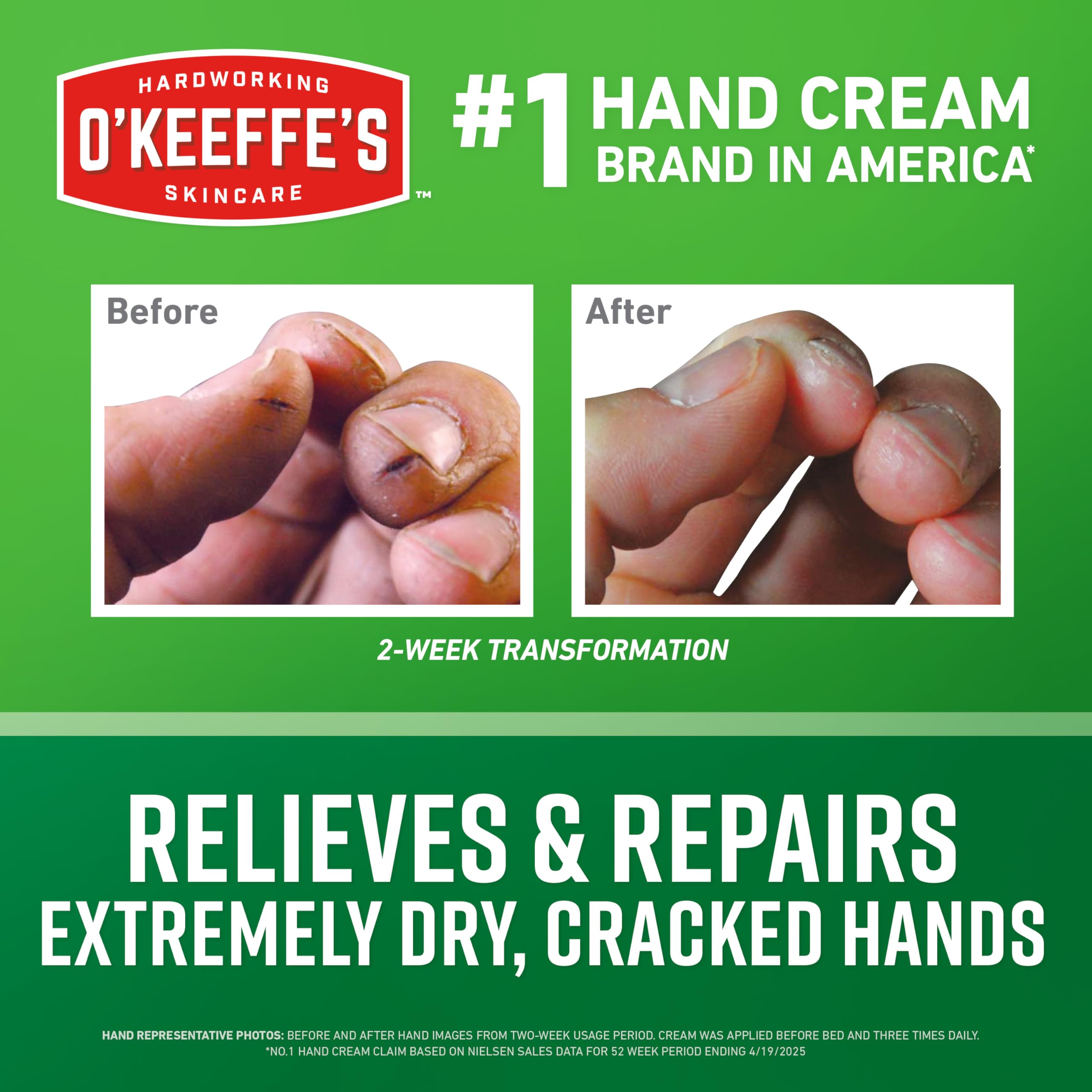 O'Keeffe's concentrated hand repair cream for cracked skin texture close up.