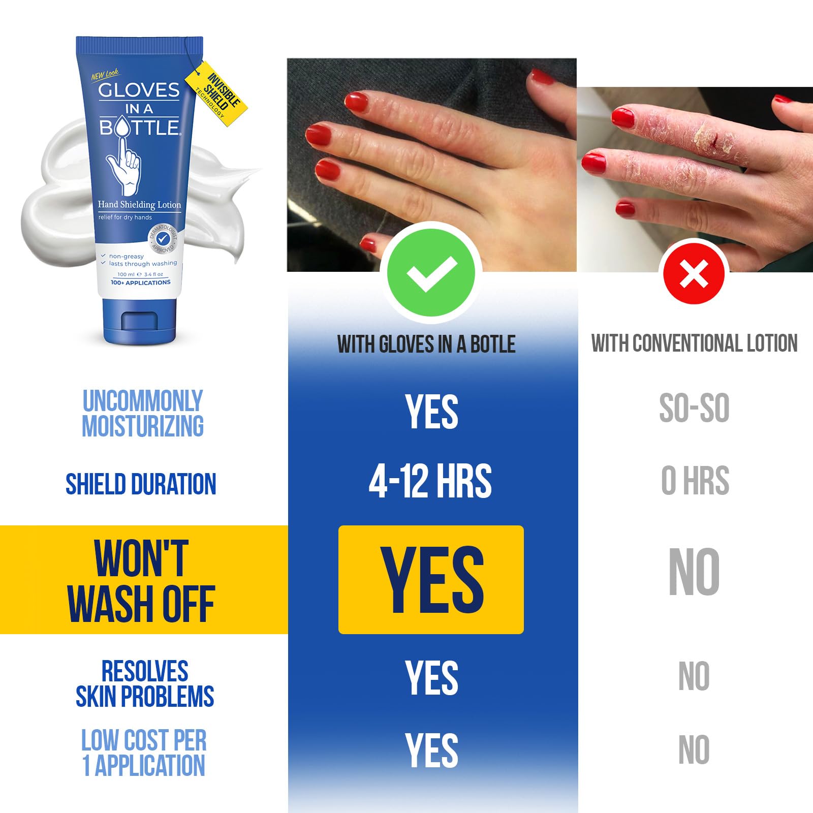 Dermatologist recommended shielding hand lotion for cracked skin repair