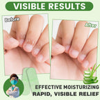 Teawoo dry cracked hands repair bandage strips close up