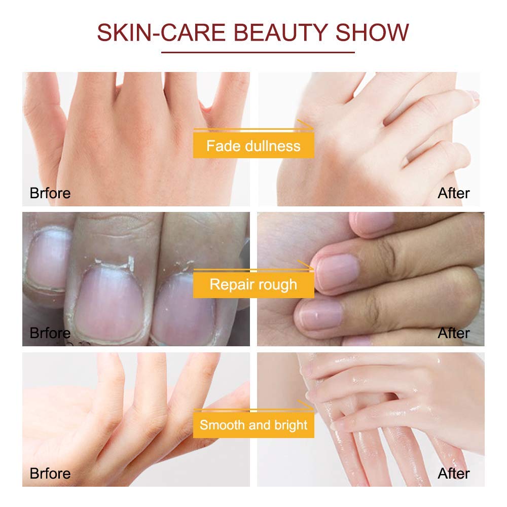 Hands wearing Zixaok moisturizing gloves for dry skin repair