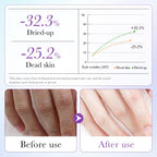 Hands wearing hydrating rose essence treatment gloves