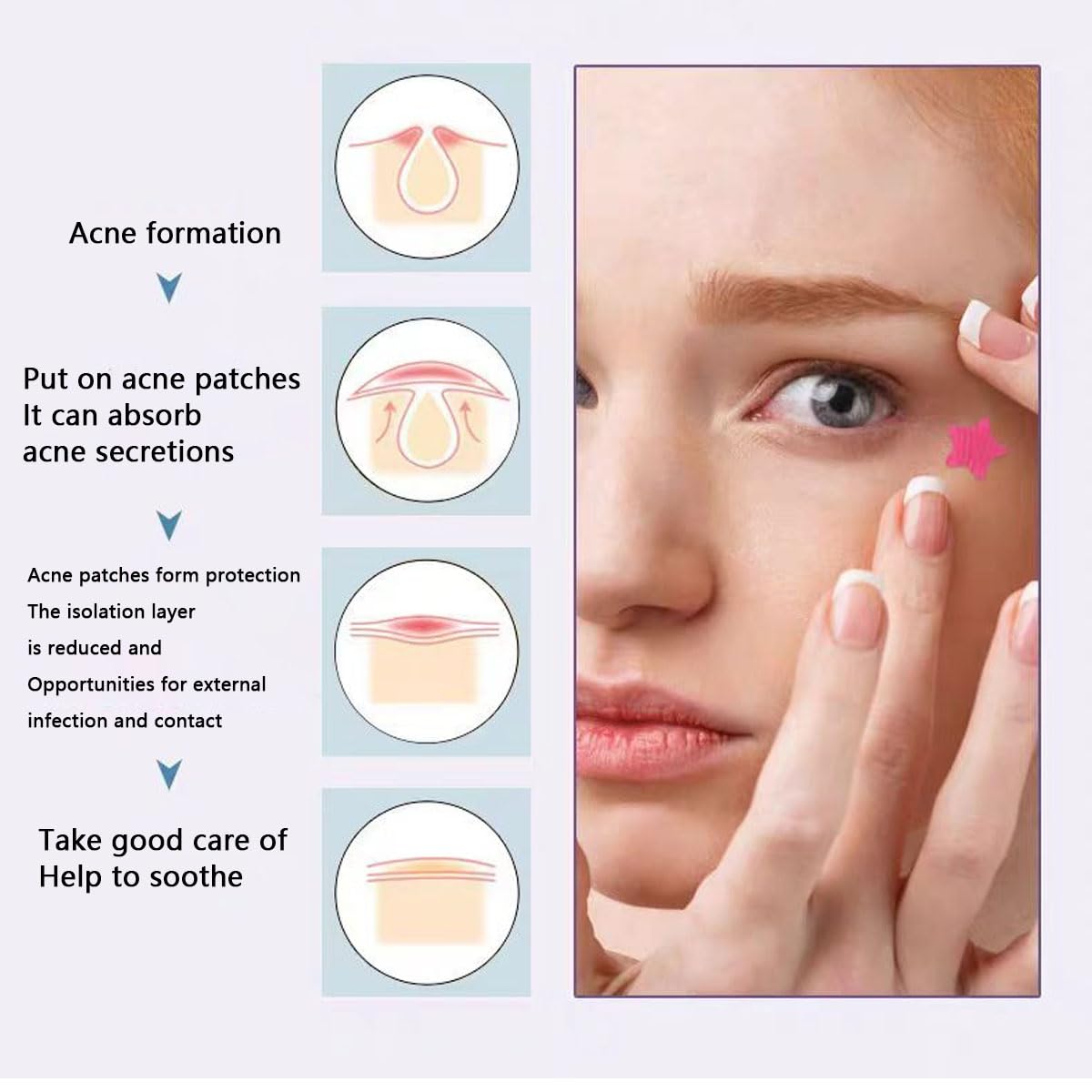 Model wearing star acne patches on face