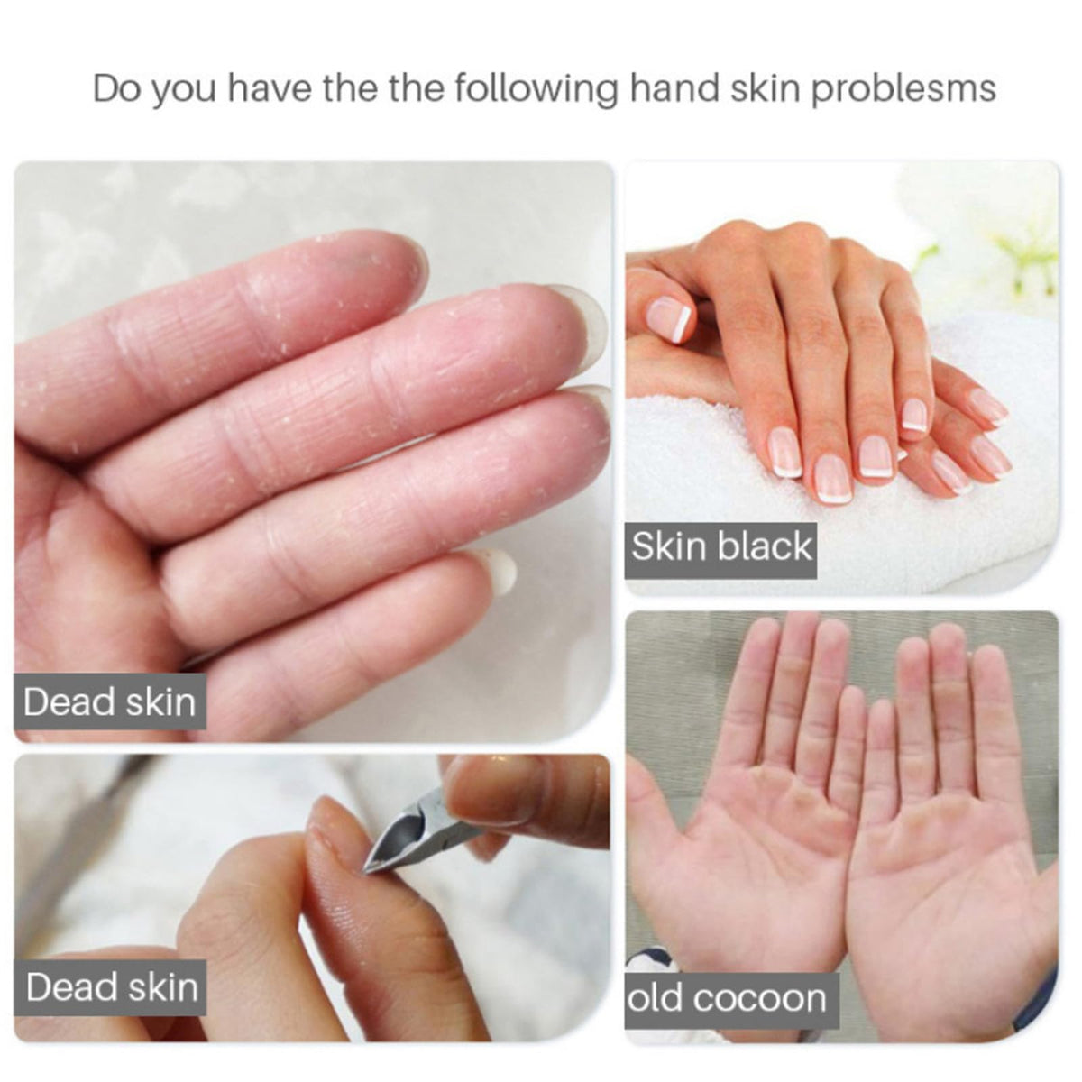 Comparison of dry skin versus hydrated skin after using hand masks