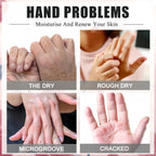 Model wearing hydrating hand repair gloves for dry skin