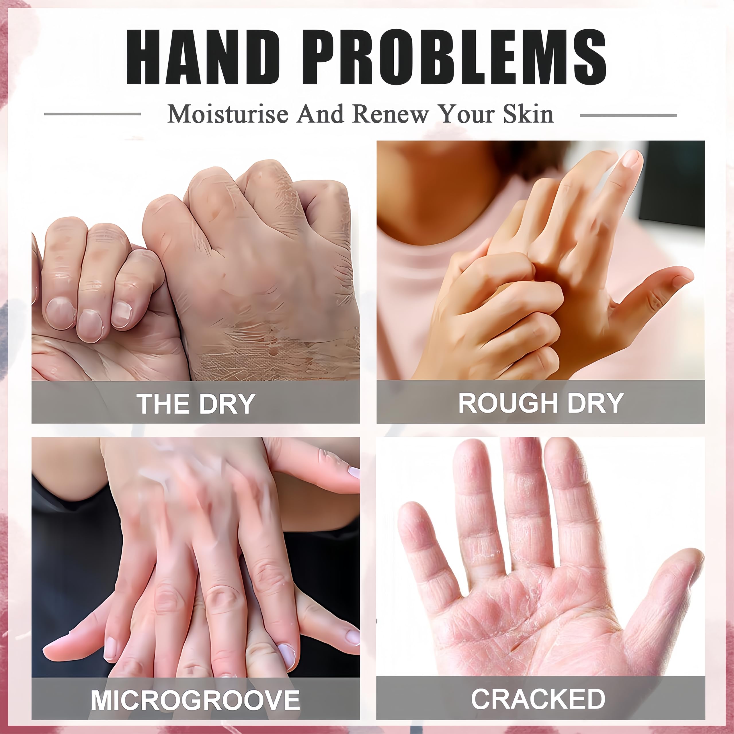 Side by side comparison of dry hands versus hydrated hands after mask