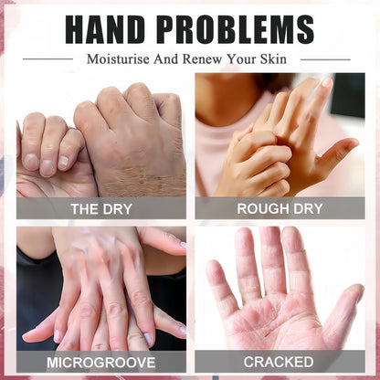 Side by side comparison of dry hands versus hydrated hands after mask