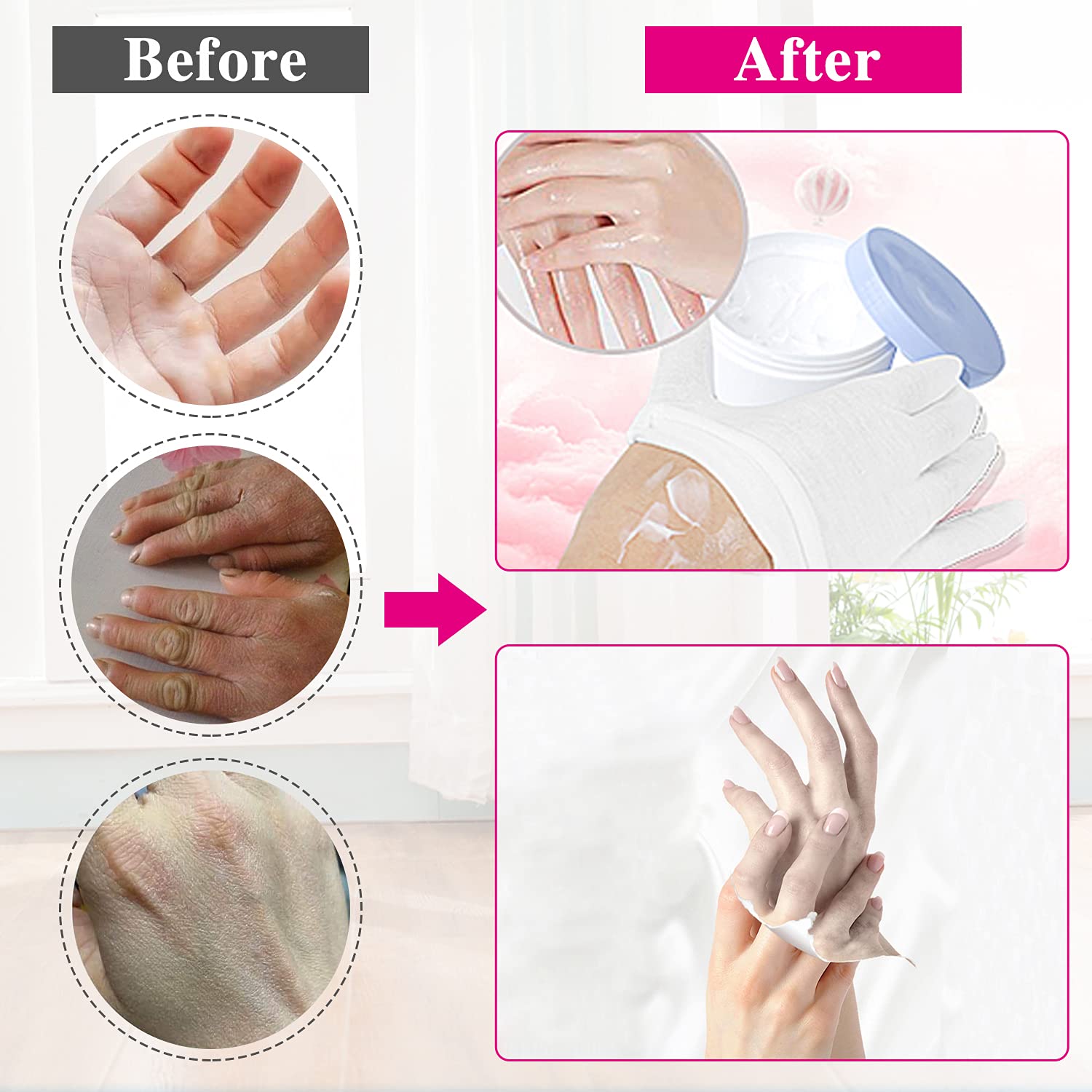 White cotton cosmetic gloves for hand treatment