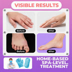 Side angle of the moisturizing spa gloves designed for hand repair and skin softening.