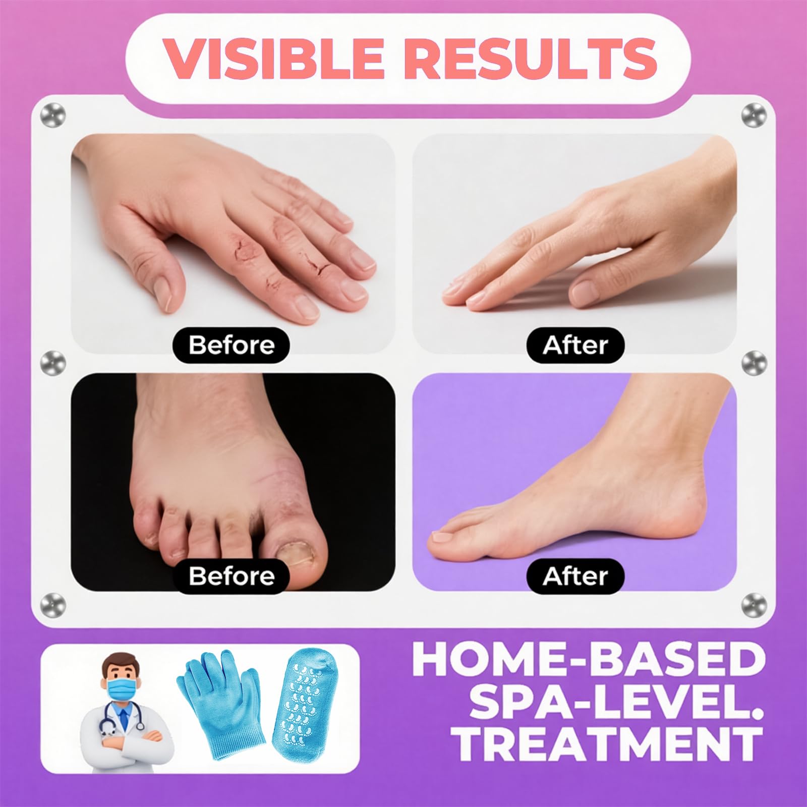 Person wearing Style Keepers moisturizing gel hand gloves