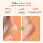 ZenToes open toe spa socks showing heel cup