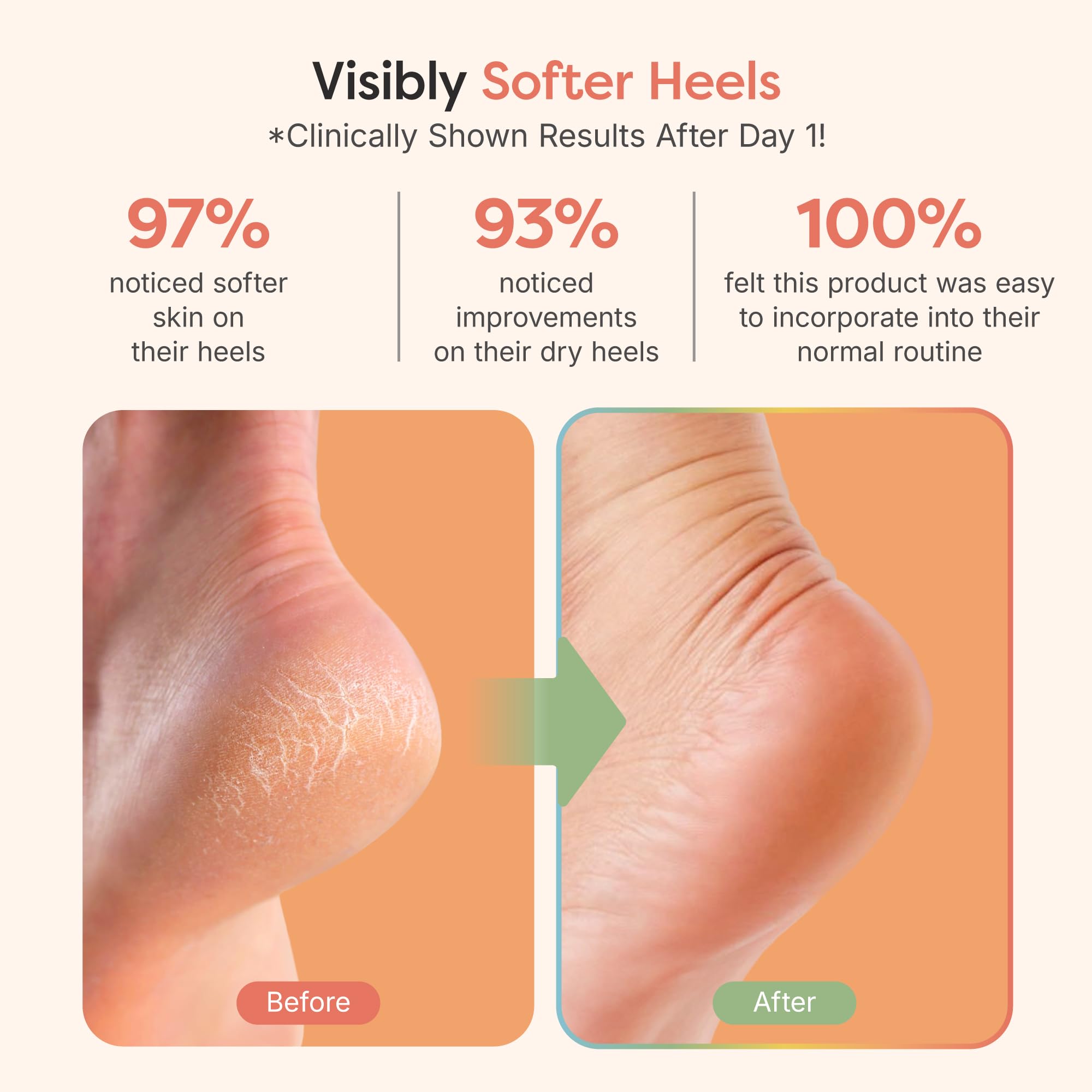 Open toe design of ZenToes moisturizing spa socks