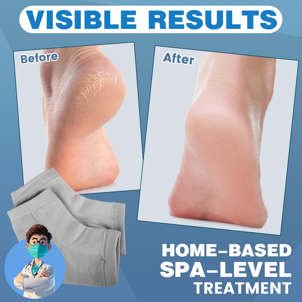 Toeless gel heel socks displayed flat on a clean surface