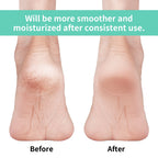 Close-up of the internal botanical gel lining infused with vitamin E inside the heel socks.