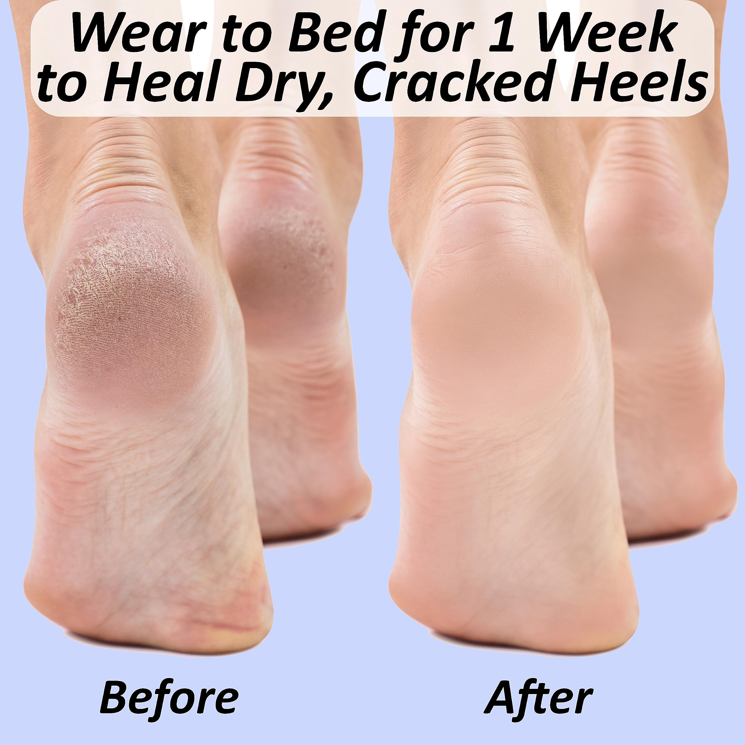 The Foot Medic reusable gel socks for soft skin