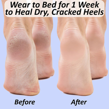 The Foot Medic reusable gel socks for soft skin