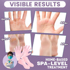 Side view of stretchy silicone socks designed for dry cracked feet