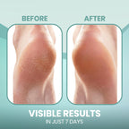 Model wearing PhysFlex moisturizing socks on feet