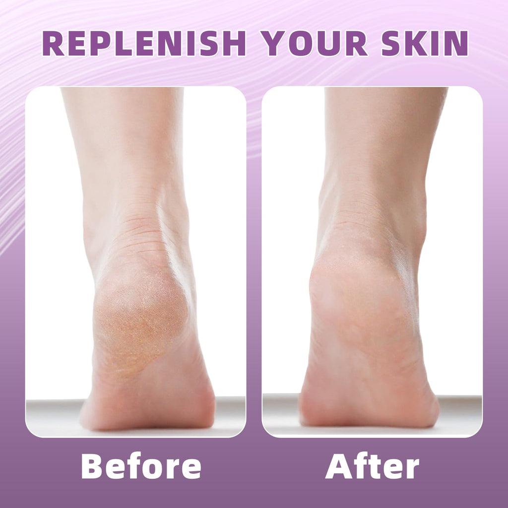 Two pairs of Untrytb moisturizing socks laid flat