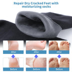 Aluroice 2 pairs of large foot care socks laid out flat