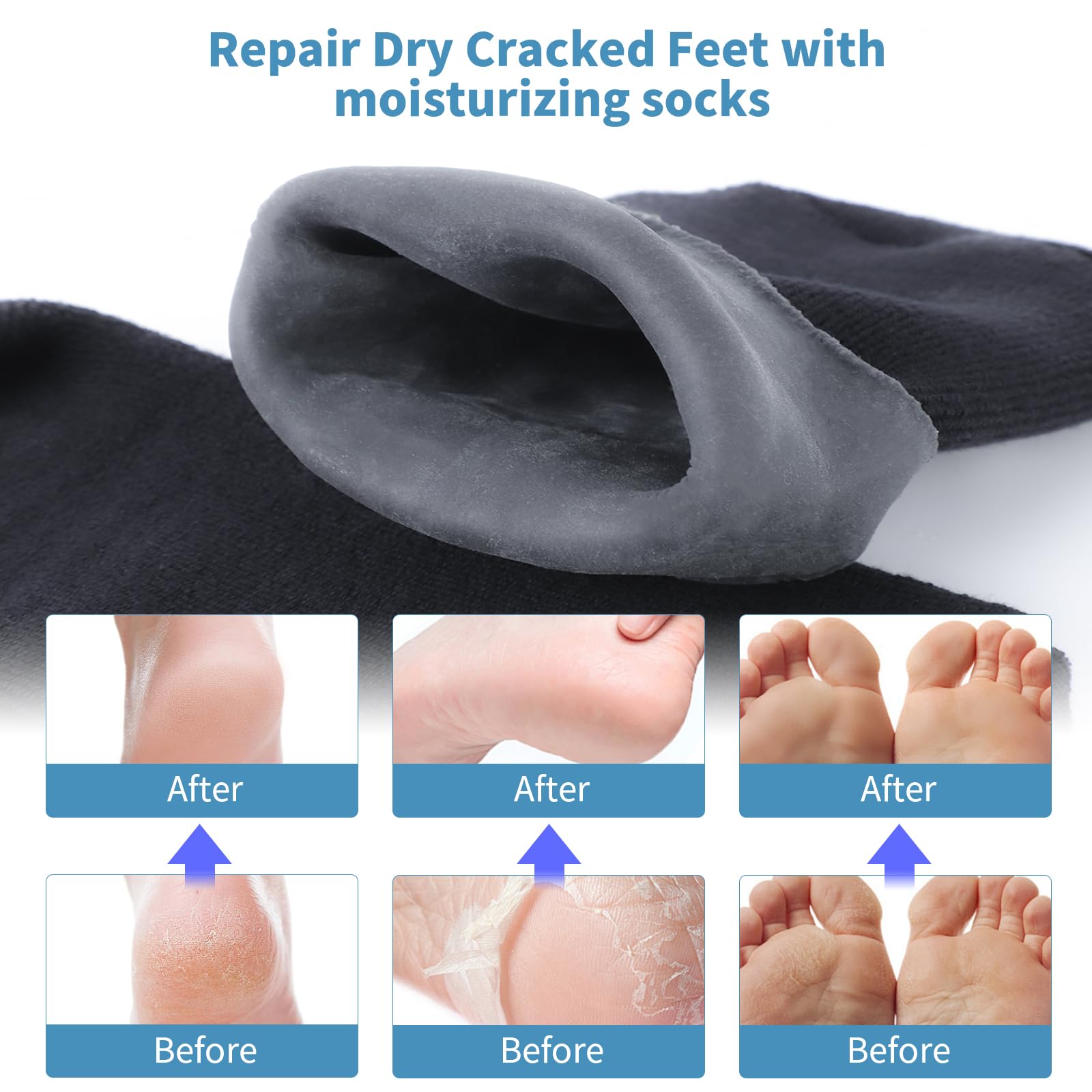 Side view of Aluroice silicone socks showing size and texture