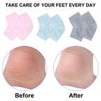 Gray, green, and pink pair arrangement of foot care sleeves