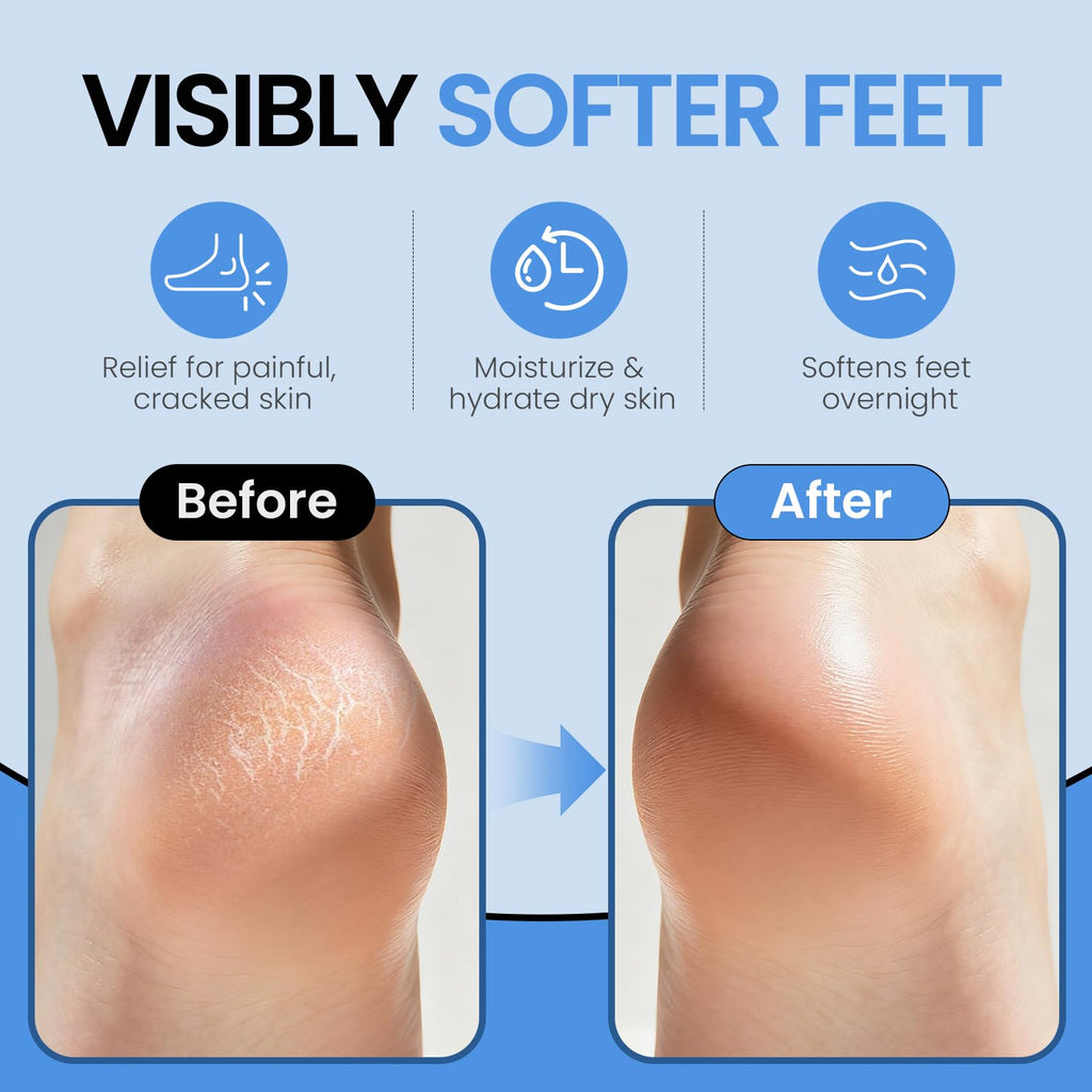 Aluroice spa moisturizing socks showing sole grip pattern