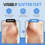 Aluroice spa moisturizing socks showing sole grip pattern
