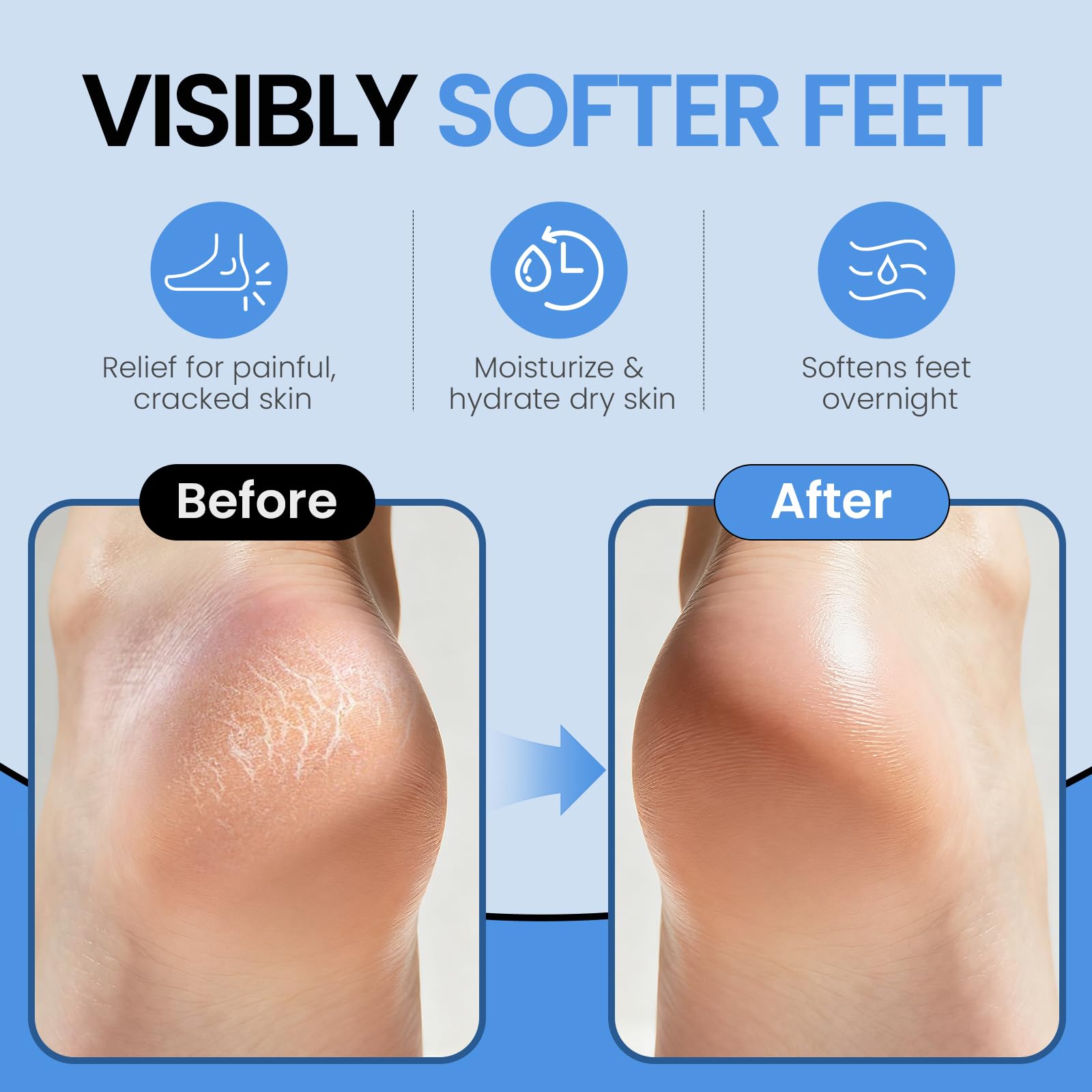 Side view of Aluroice moisturizing socks on feet