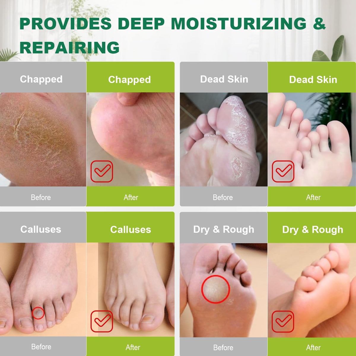 Full bulk pack of 300 pieces disposable foot film covers for salon use