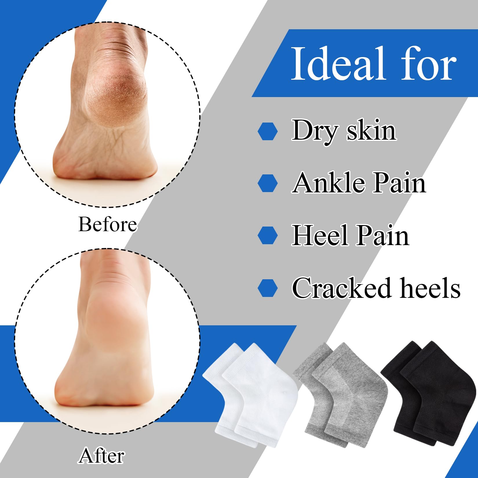 Woman wearing toeless silicone socks for cracked heel treatment