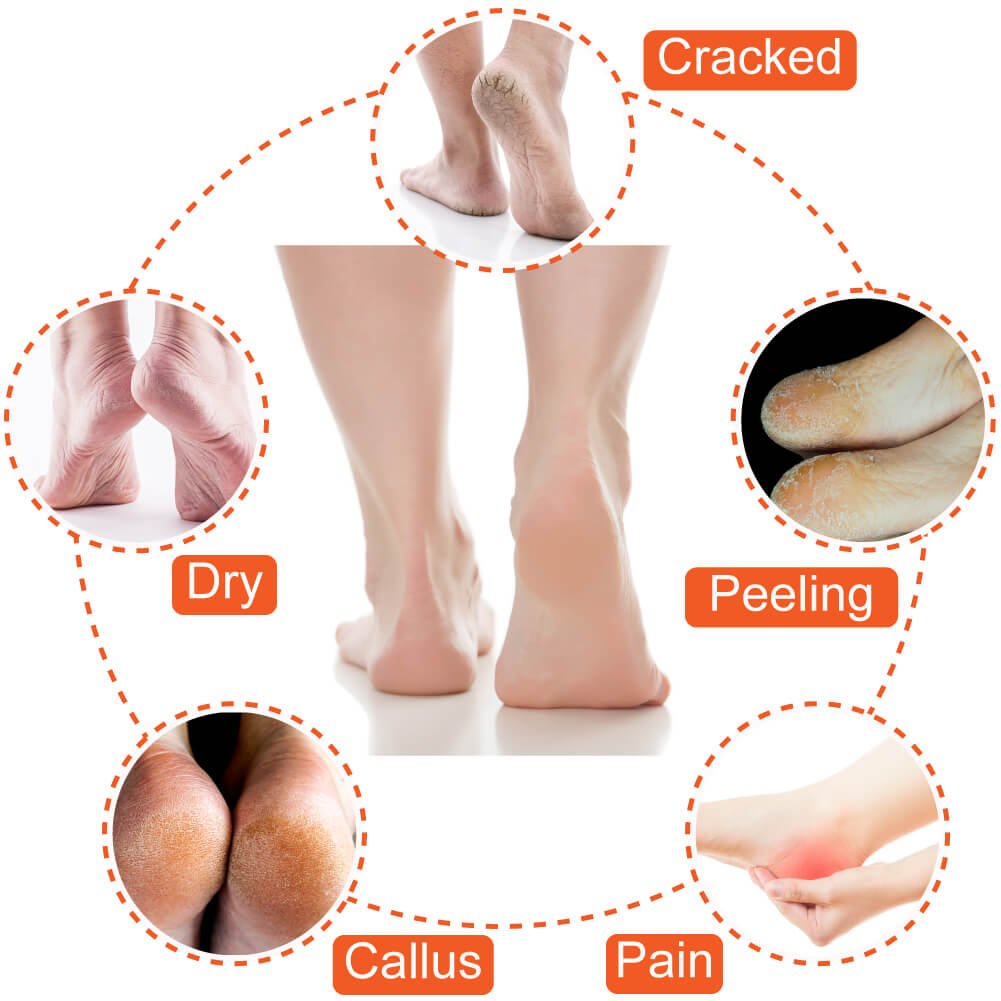 Side profile of the gel heel socks demonstrating ergonomic fit