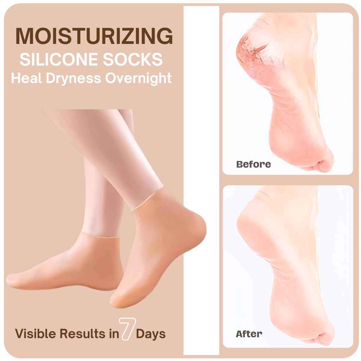 Yoeeco moisturizing gel socks for cracked heels on feet