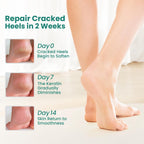 Welnove foot care socks displayed showing breathable cotton fabric