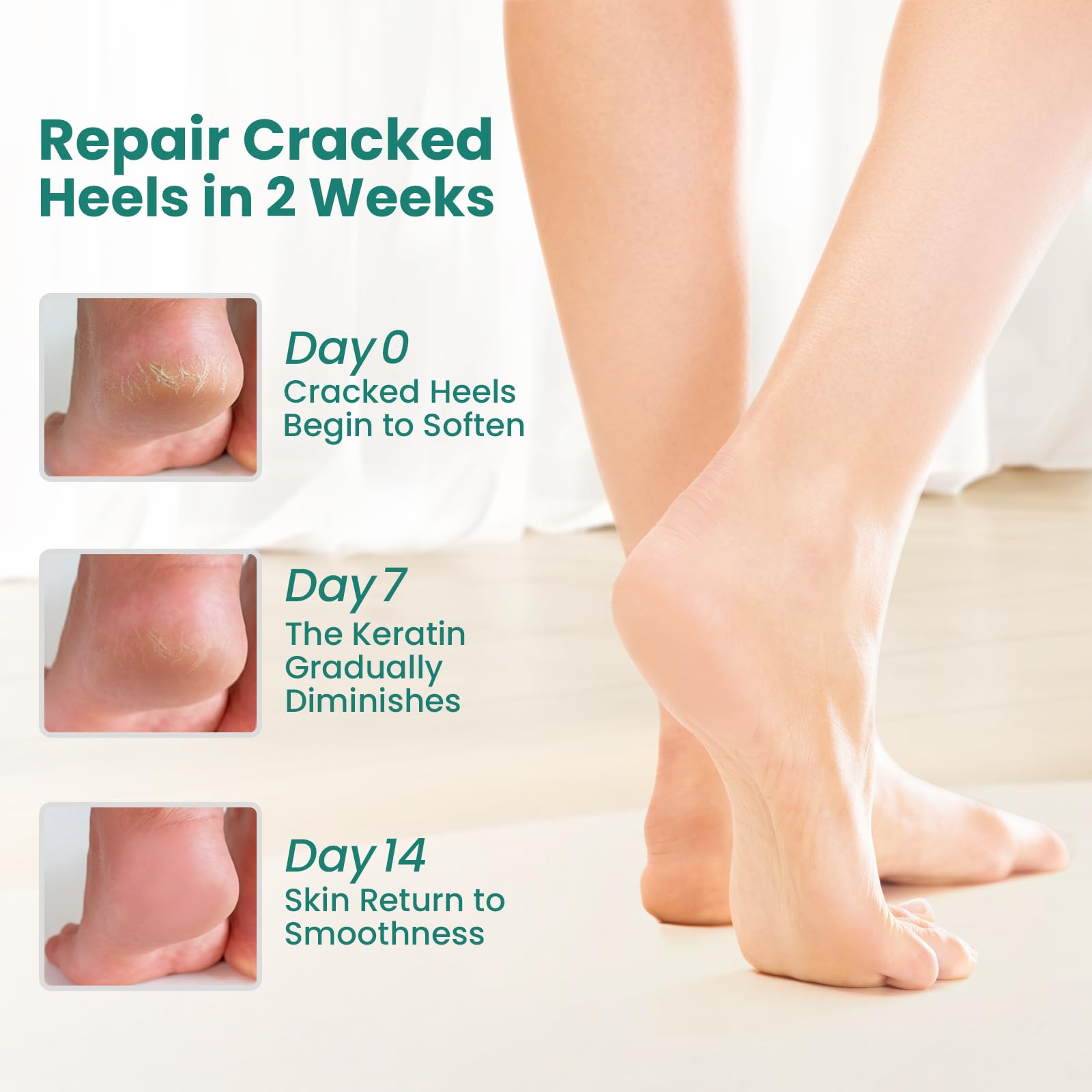 Welnove gel heel socks showing aloe vera infused lining detail