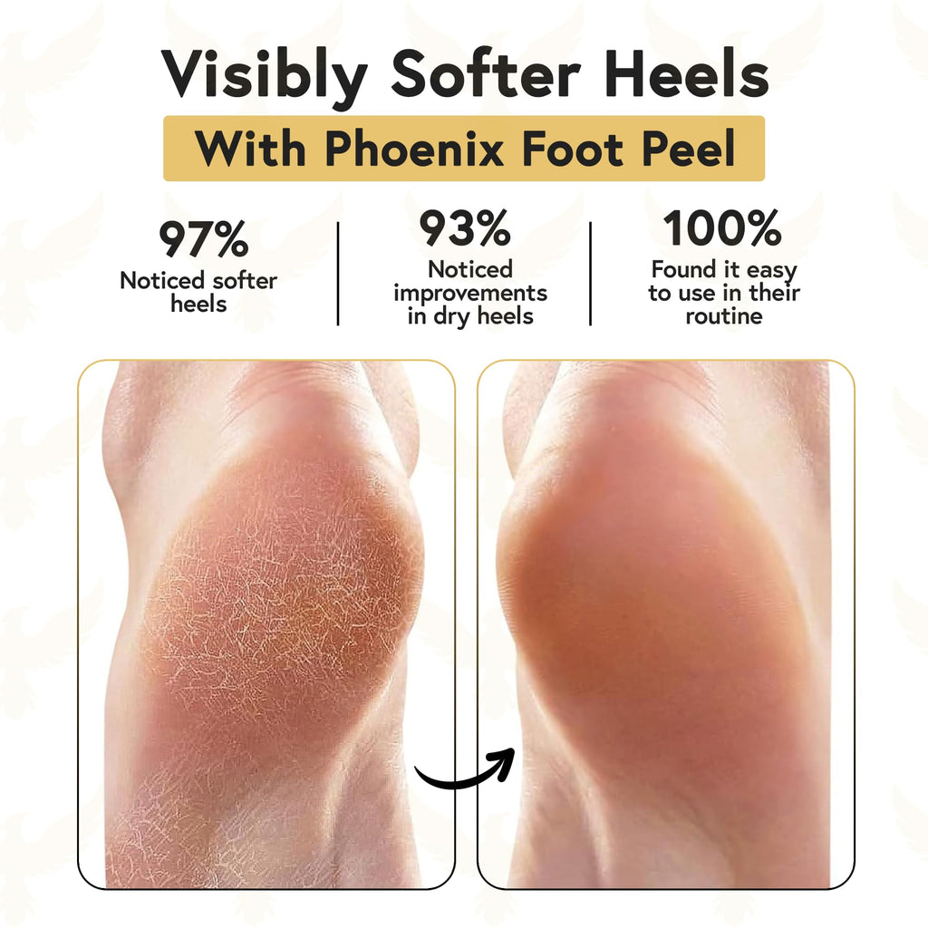 Extra large black spa socks showing inner silicone gel lining
