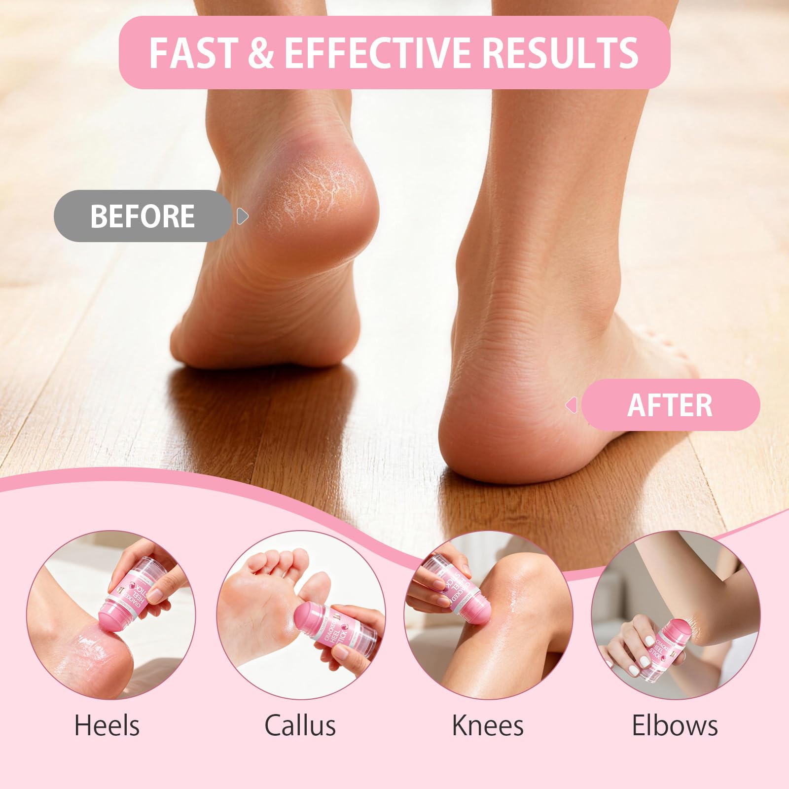 Teawoo gel socks for dry cracked feet