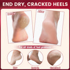 Reusable moisturizing gel heel socks laid flat displaying the breathable fabric material