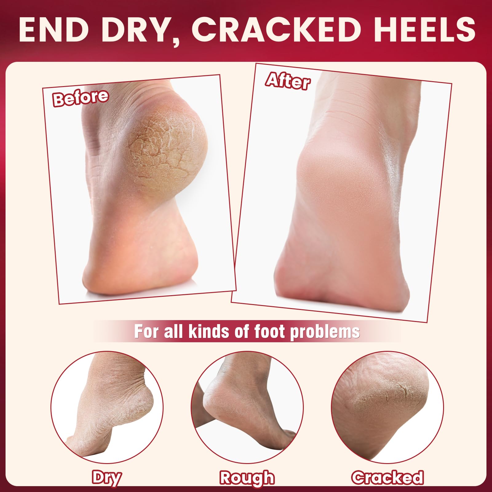 Teawoo moisturizing heel socks for dry feet treatment