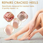 MoyRetty hydrating gel socks lifestyle application on feet
