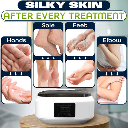 Foot spa thermal therapy application using KETAR paraffin bath machine